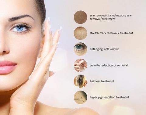 Graphic showing benefits of microneedling